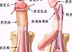 男性包茎整形图片对比